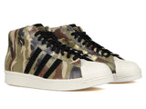X COMPLEX PRO MODEL 80'S - BTKA_14647996281893904_b7aa5d0662fd3e79259a18873a571d